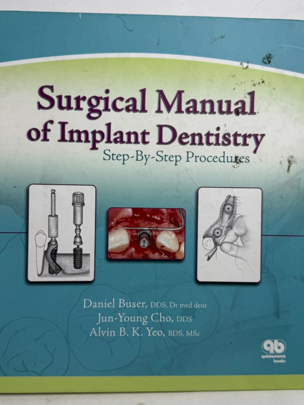 Surgical Manual of Implant Dentistry: Step-by-Step Procedures - Buser Cho Yeo